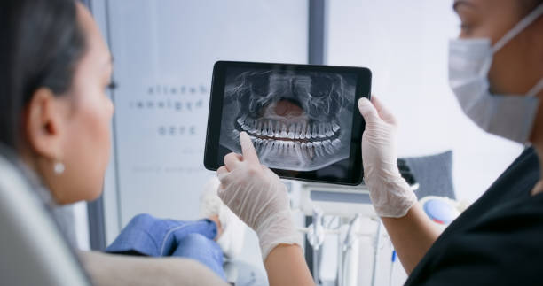 Licensed Teeth Whitening service in East Gaffney, SC - Smile Center Dentistry